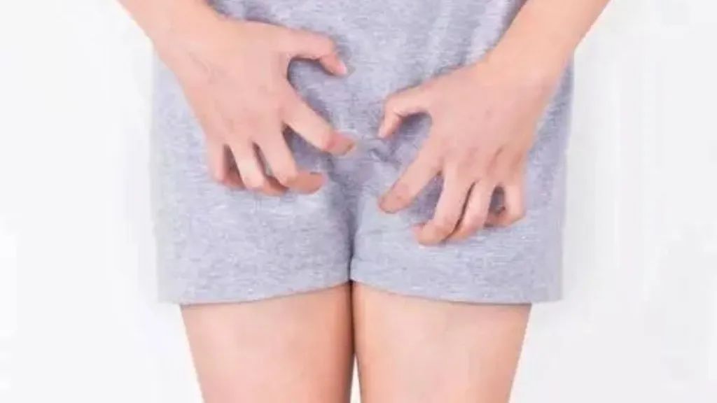 哪些女性是外阴白斑易发人群?