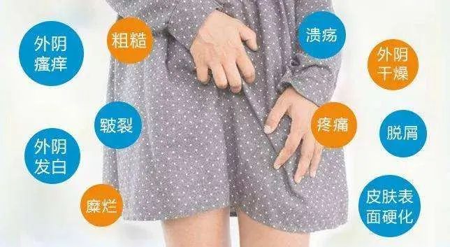 成都蓉城外阴白斑研究所