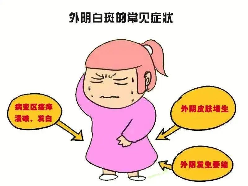 哪些女性容易患上外阴白斑？