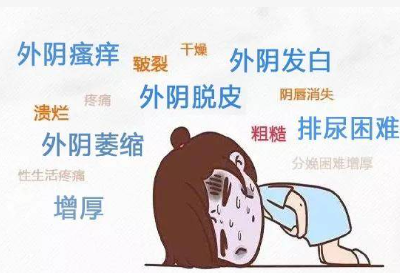 得了外阴白斑后可以根除吗