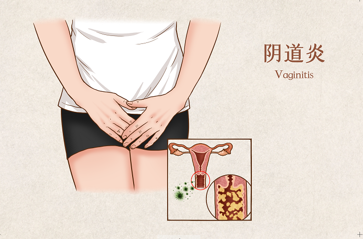 为什么初春时节私处就特别容易痒呢？