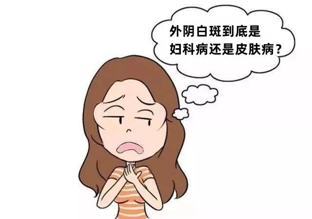 得了外阴白斑应该挂什么科?