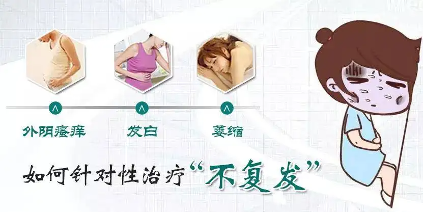 外阴白斑最好的治疗方法是什么?